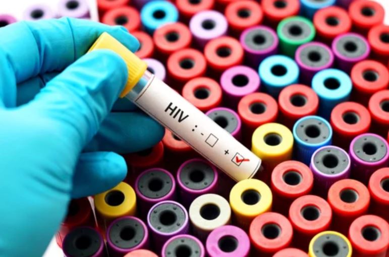 Spread of Hiv/Aids And The Stigma Around It